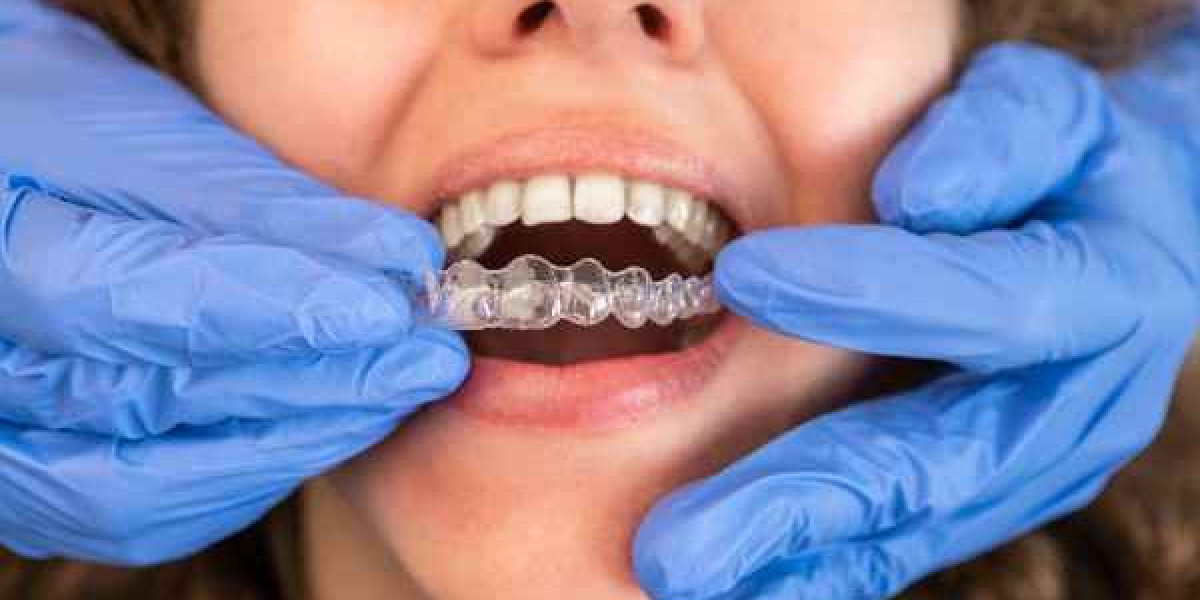 Affordable Options for All Smile Needs in Bicester